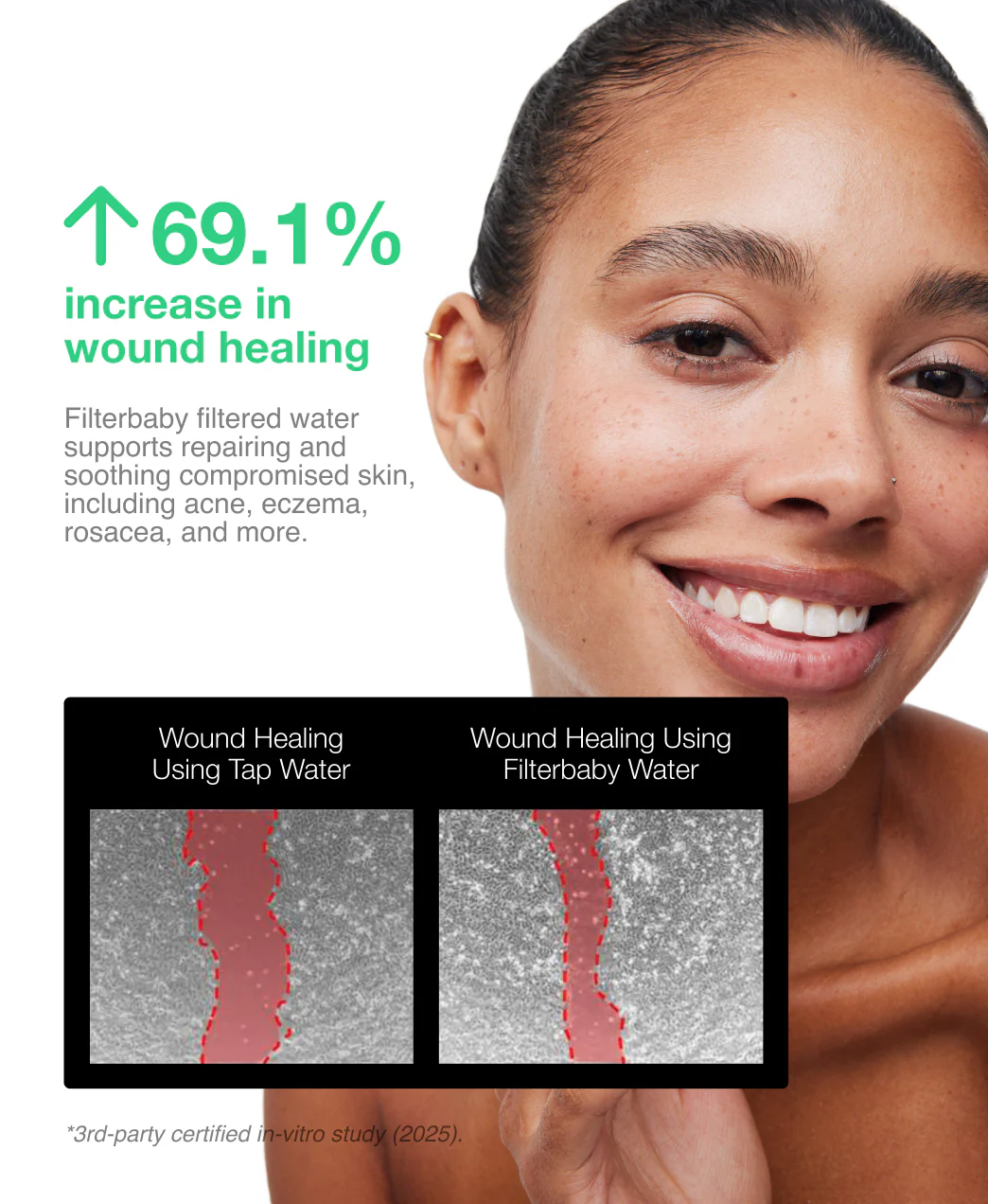 Filterbaby Skincare Filter 2.0 + 2 FREE Gifts - Image 36